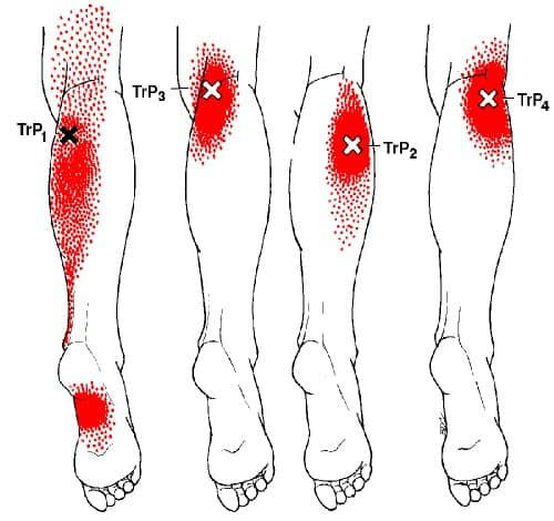 The Calf, Ankle, and Heel Pain Trigger Points - YouTube
