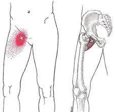 an area of groin pain is indicated in the top of the right leg
