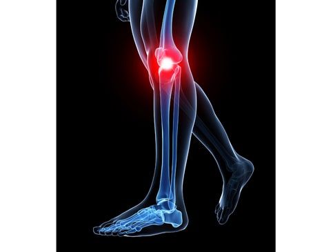 A red area in the illustration of the knee indicates pain under the knee cap