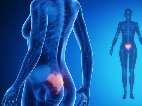 a illustration of a human body showing the location of pain in the sacrum