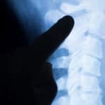 A finger points to the cervical spine on an x-ray