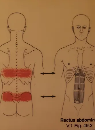 common areas of lower back pain - upper and lower lumbar regions