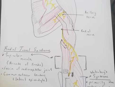 drawing of the location of the radial nerve, supinator muscle, extensor tendons and axillary nerve